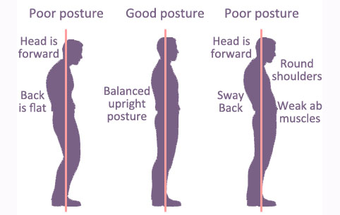 Is Your Poor Posture Causing Back Pain?