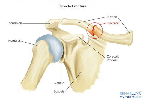 Shoulder Pain Cause,Treatment | ReLiva Physiotherapy & Rehab