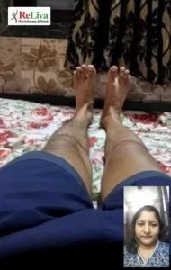 1 ACL tear knee pain assessment online physiotherapy lit