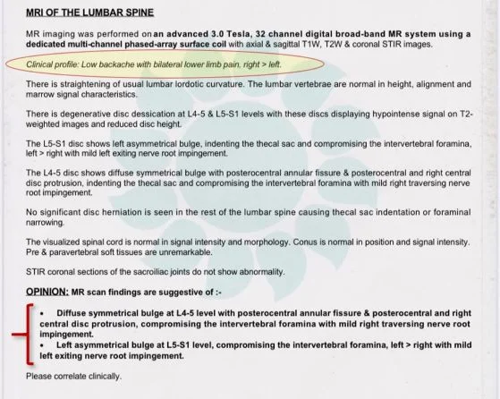 1 MRI of lumbar spine lite