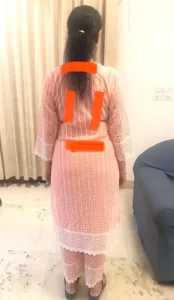 2 PIVD with lateral shift assessment lite