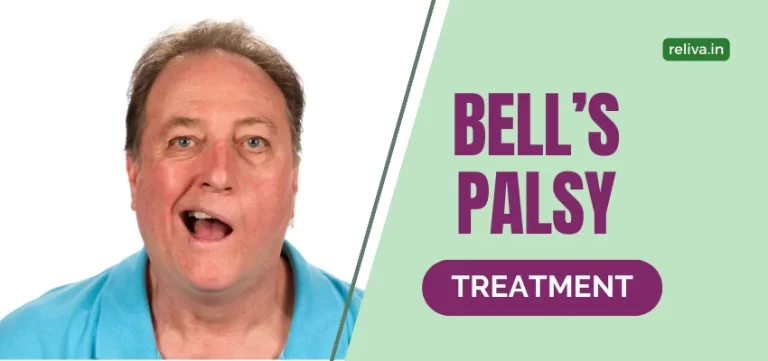 Bell’s Palsy Treatment with ReLiva Physiotherapy