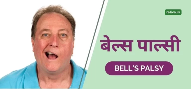 Bells Palsy ilaj Hindi