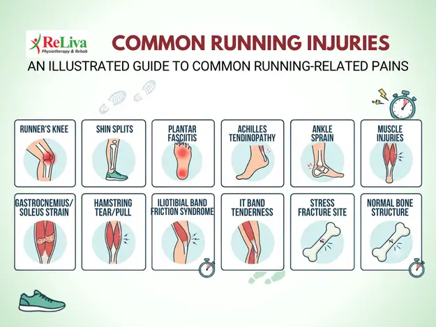 Common Running Injuries