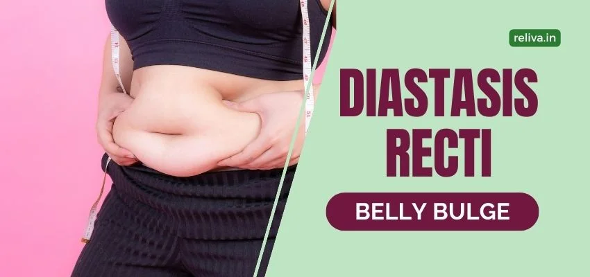 Diastasis Recti: Post Pregnancy Belly Bulge