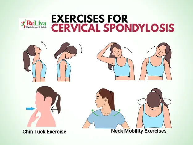 Exercises for Cervical Spondylosis