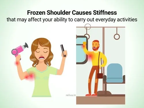 Frozen shoulder causes stiffness