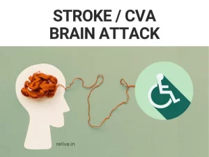 Stroke CVA brain attack