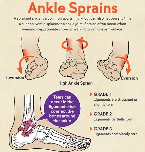 ankle sprain causes