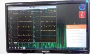 cardiac rehab monitoring