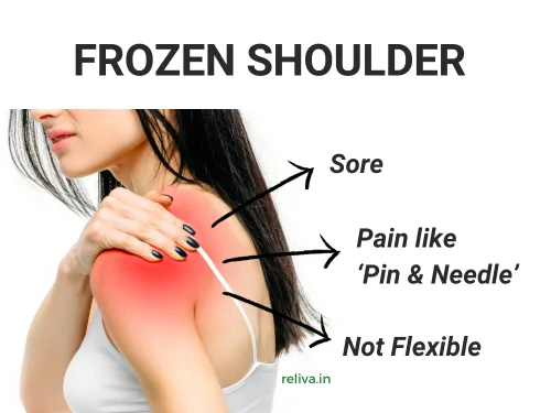 frozen shoulder symptoms