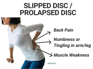 slipped disc symptoms