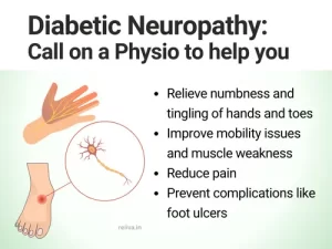 Diabetic Neuropathy call on a physio to help