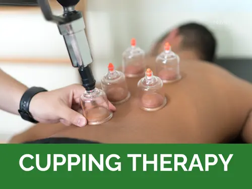 Cupping Therapy