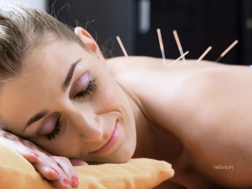 dry needling therapy for pain relief