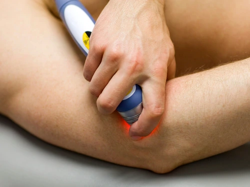 laser therapy for soft tissue injuries