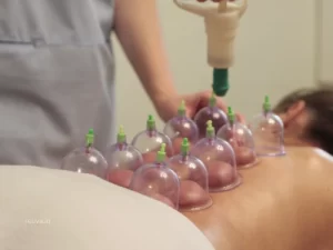 Cupping Therapy Physiotherapy Treatment in Mumbai