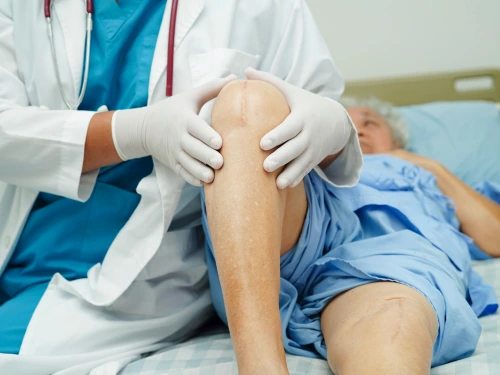 Physiotherapist after Knee Replacement