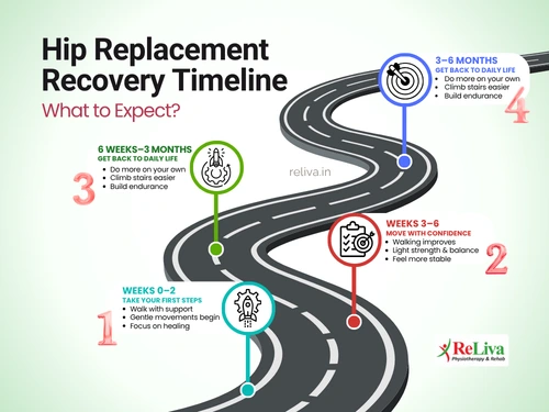 Hip Replacement Recovery Timeline Week-by-Week Guide