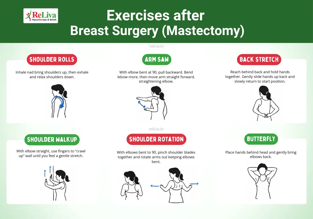 Post Mastectomy Lymphedema Exercises and Therapy