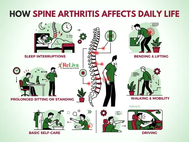 How Spine arthritis affects Daily Life