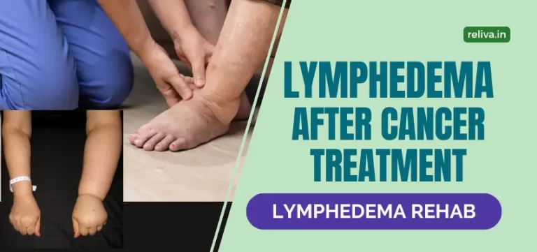 Lymphedema After Cancer Treatment Physiotherapy Management