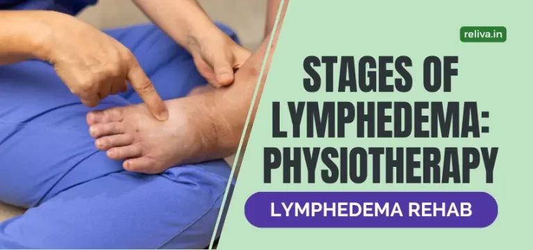 Stages of Lymphedema and How Physiotherapy Helps at Each Stage