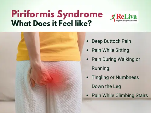 Piriformis Syndrome symptoms
