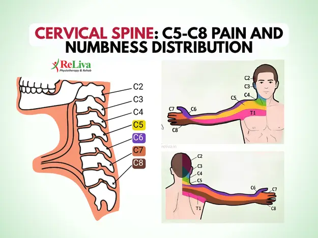 Cervical Spine C5-C8 Pain numbness distribution Image